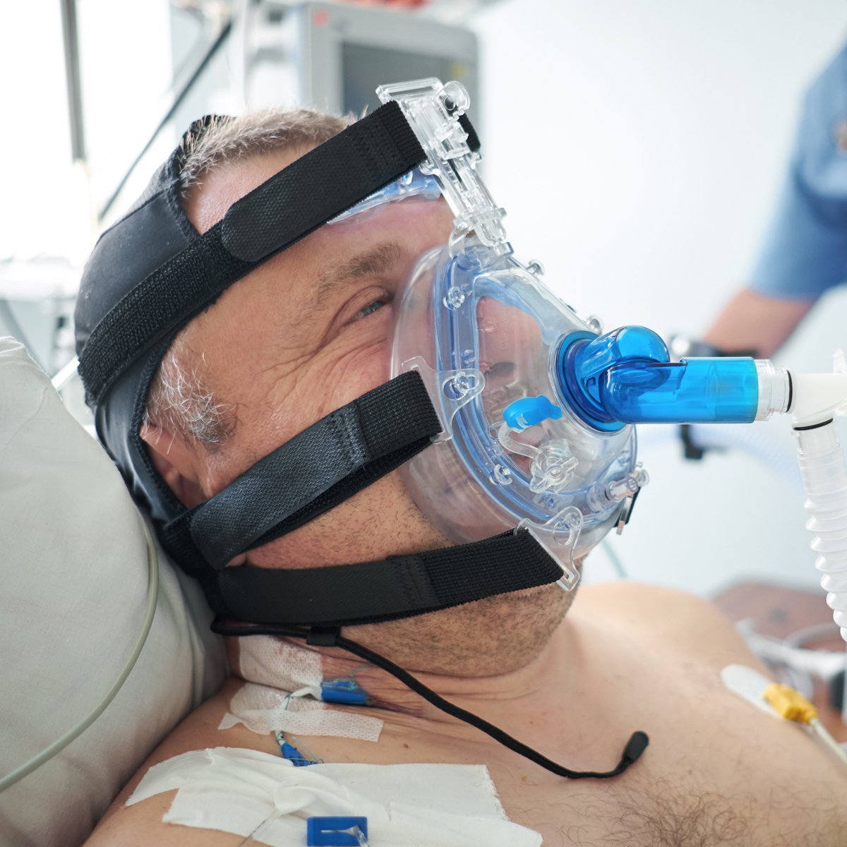 O2 Issues Oxygen issues during the Covid-19 pandemic